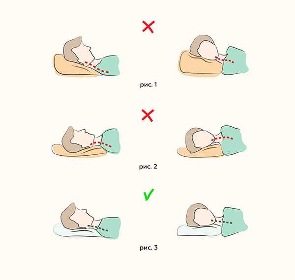 Работает ли подушка от морщин на самом деле?